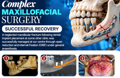 Maxillofacial Case